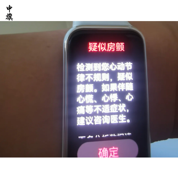 智能手环测血压靠谱吗？